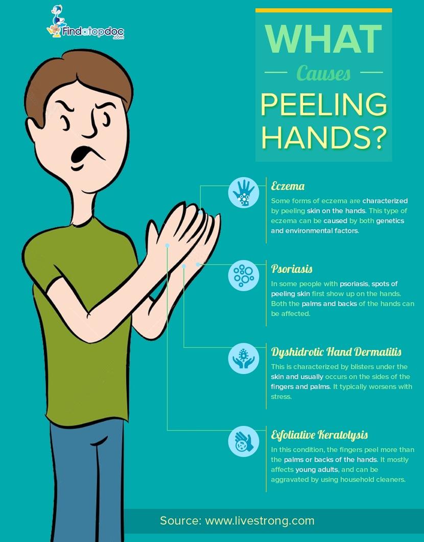 How To Get Rid Of Peeling Skin