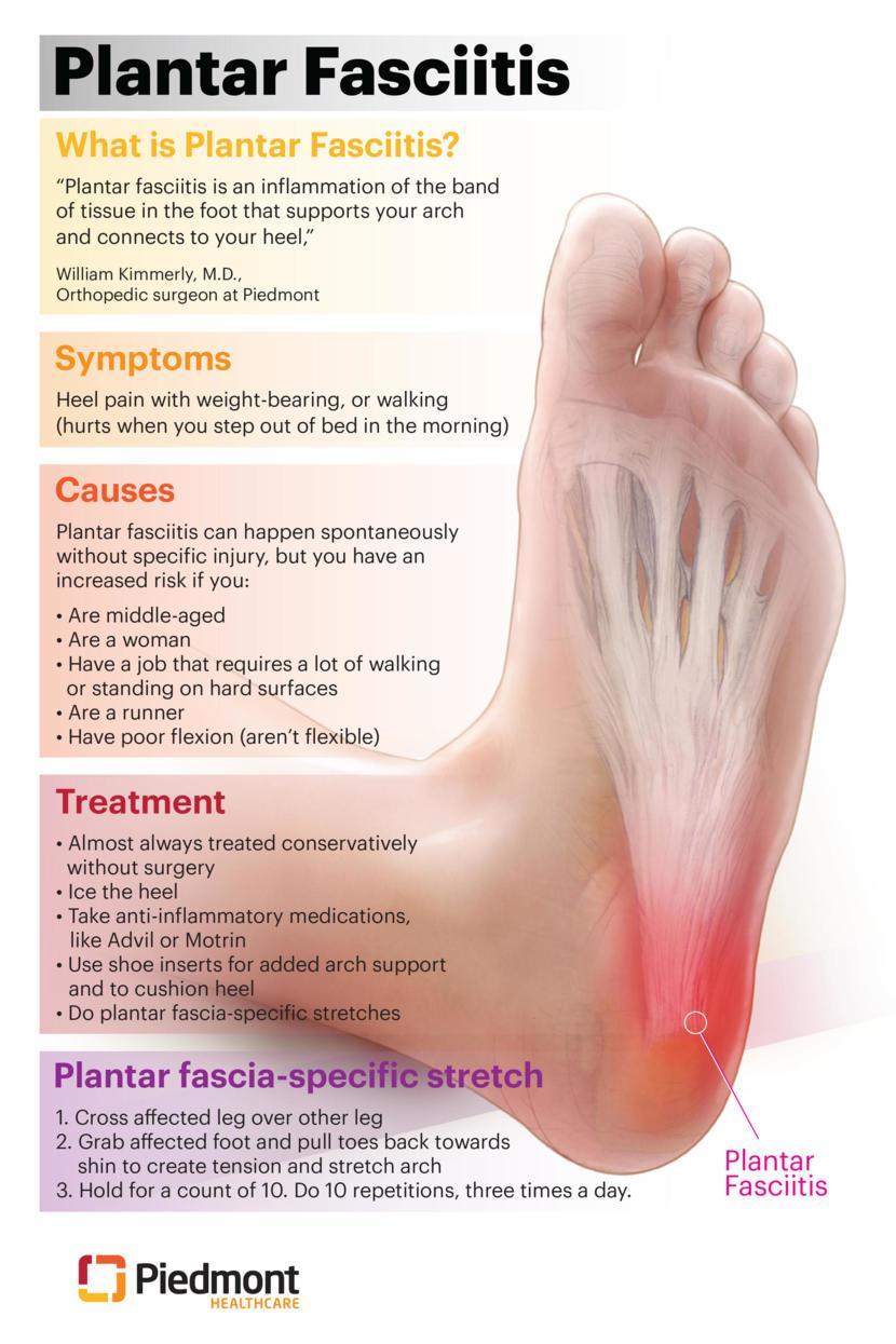 Plantar Fasciitis: What Is It, Symptoms, Treatment, and More | Osmosis