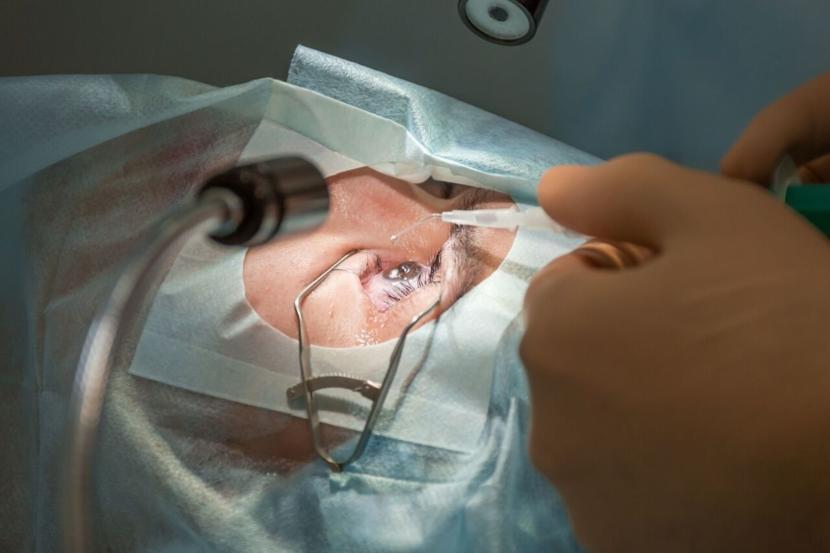 Lasik Eye Surgery For Astigmatism