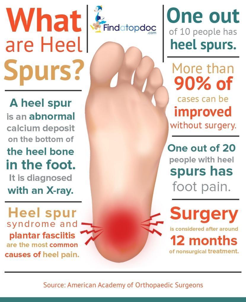 Heel spur treatment: 6 common misconceptions about it!