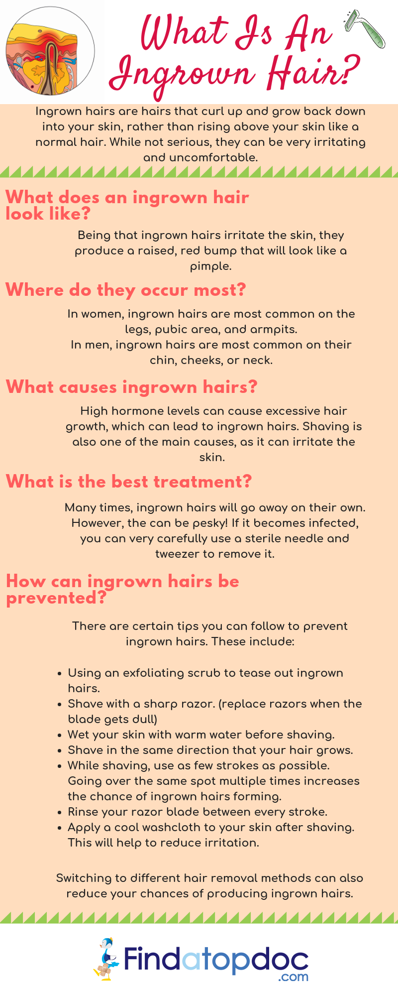 What are the Signs and Symptoms of an Ingrown Hair?