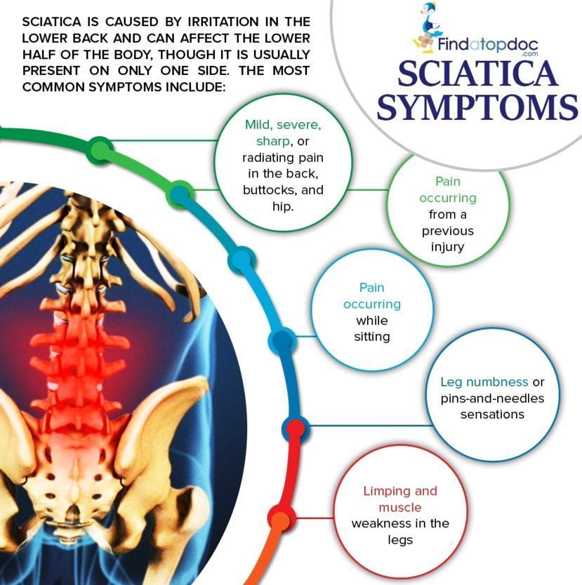 https://www.findatopdoc.com/var/fatd/storage/images/_aliases/article_main/media/images/sciatica/439713-1-eng-US/Sciatica.jpg