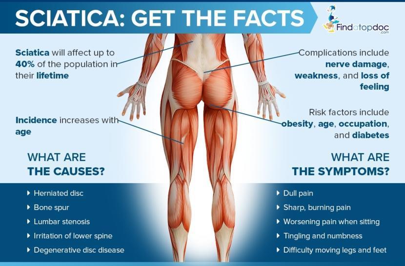 Sleep Tips to Reduce Piriformis Syndrome Pain and Sciatica Infographic