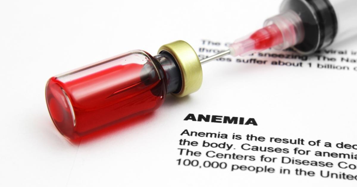 Do I Have Anemia?