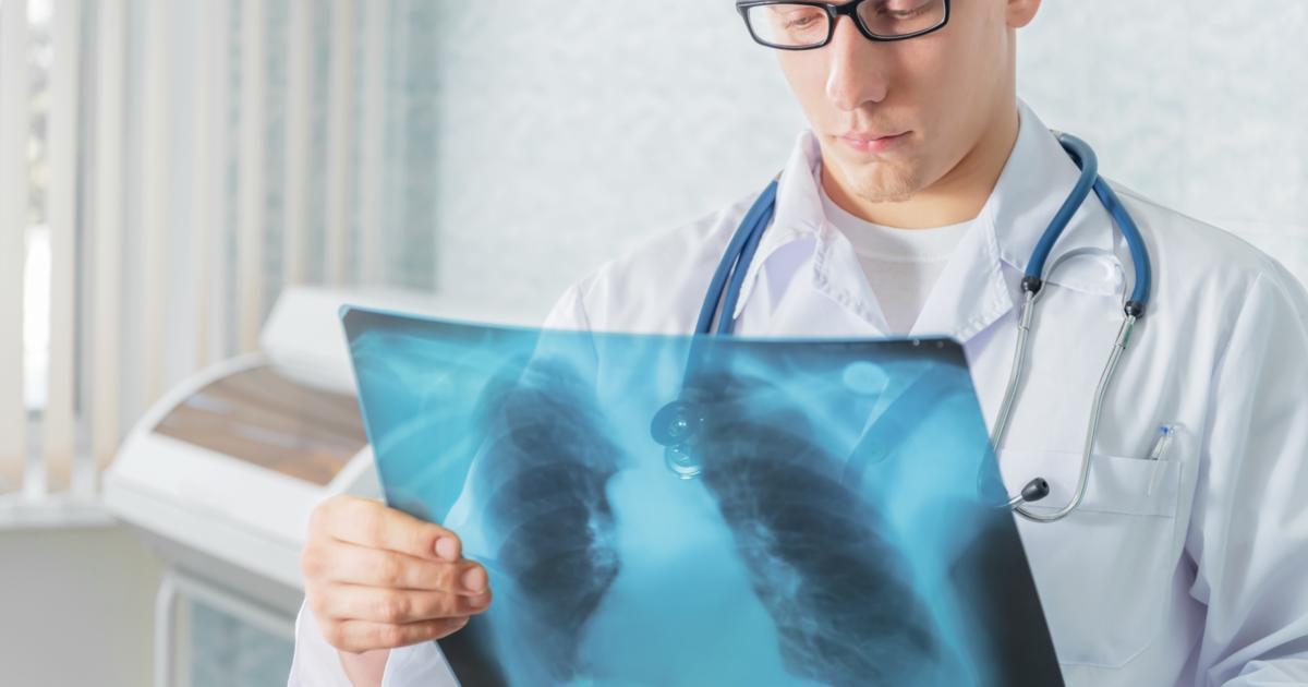 Pneumonia With Lung Cancer: What You Need To Know