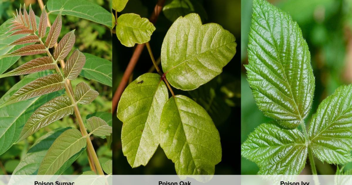 Poison Ivy Oak Sumac Rash Differences