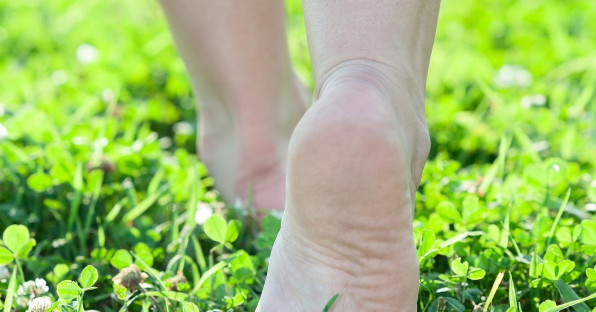 What are Bunions?