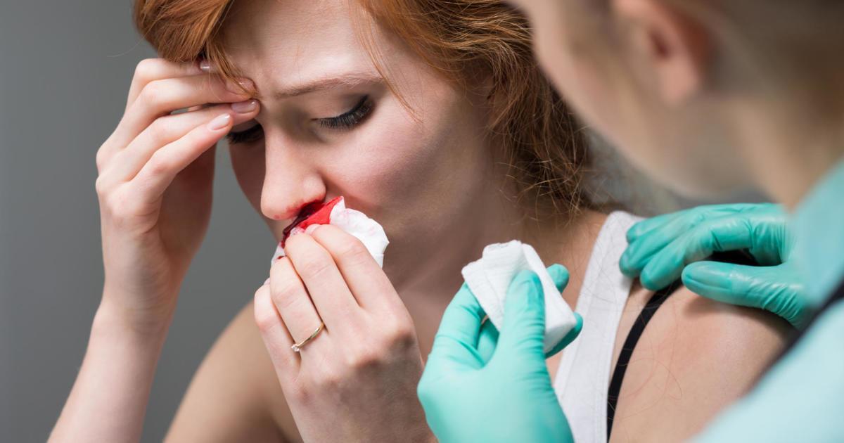 What Is Epistaxis: Causes, Symptoms, and Treatment