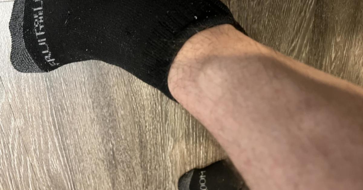 Bump near my right ankle?