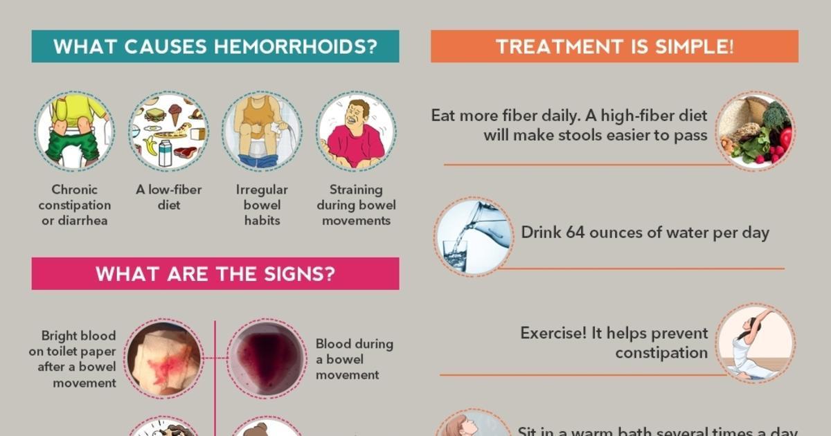 What Is Hemorrhoids Facts About Hemorrhoids Infographic 2186