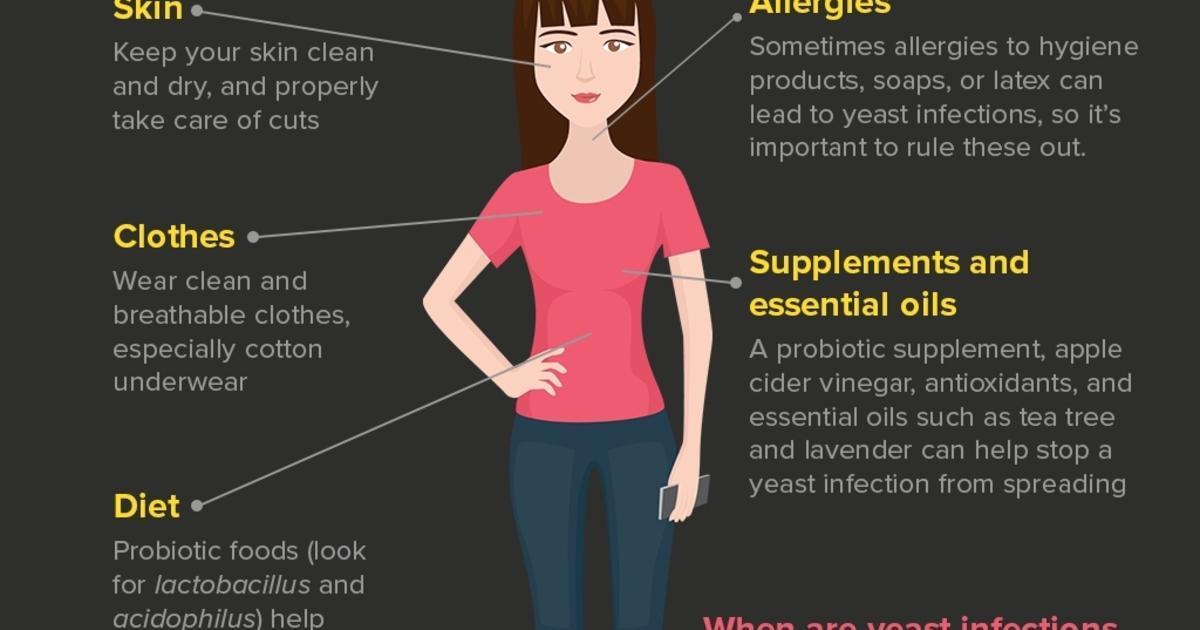 Image result for Yeast Relief: Safe Treatment Tips infographics