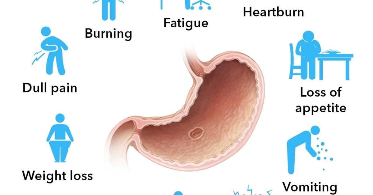 gastric ulcer signs and symptoms