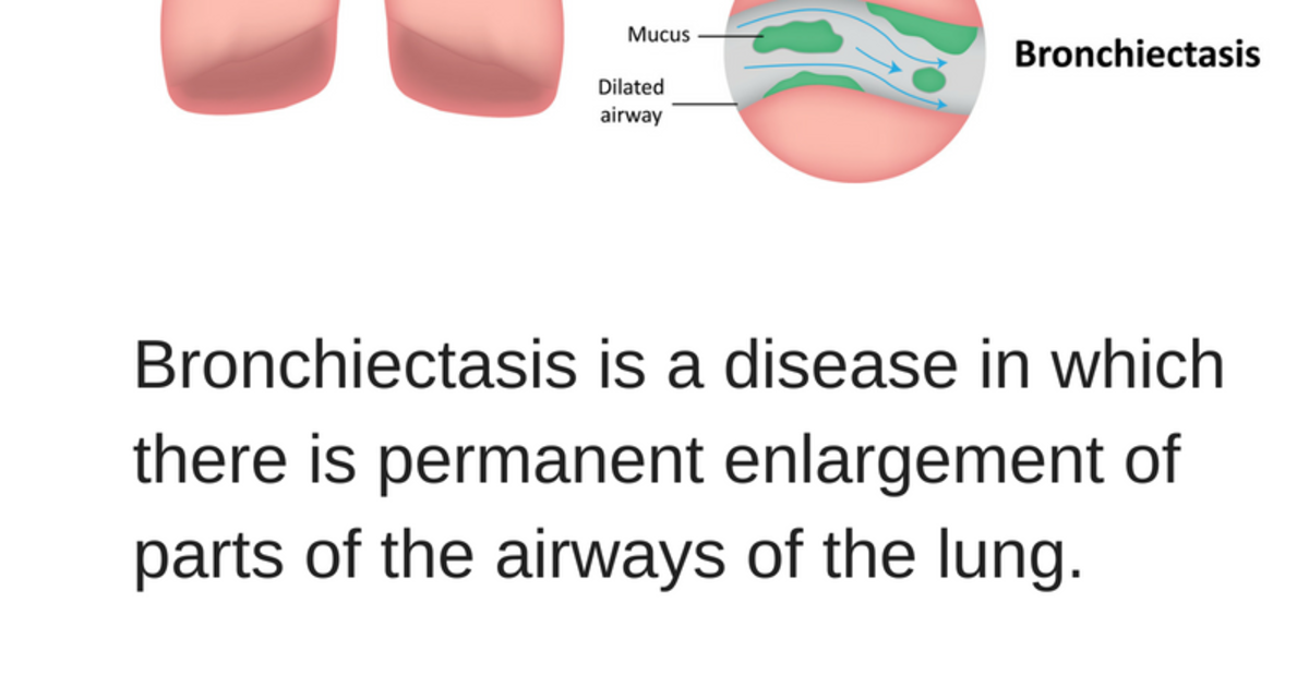 what-is-bronchiectasis