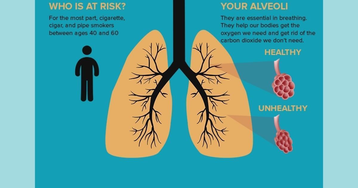 what-is-emphysema-get-the-facts-infographic