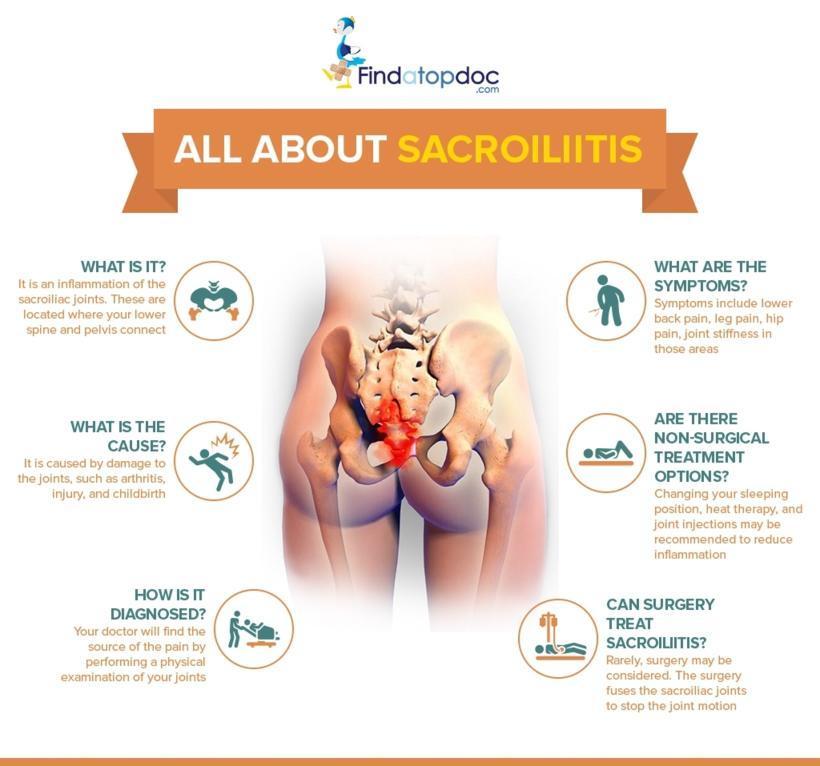 https://www.findatopdoc.com/var/fatd/storage/images/_aliases/infographic_main/top-videos-and-slideshows/sacroiliitis/450475-1-eng-US/Sacroiliitis.jpg