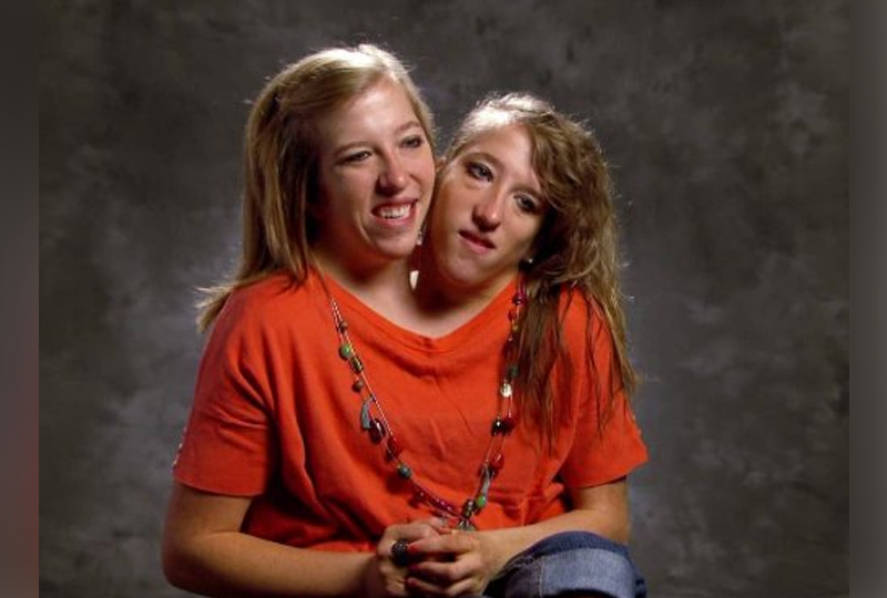Conjoined Twins Abby and Brittany Prepare for Their First Day of School as  Newly Hired 5th Grade Teachers
