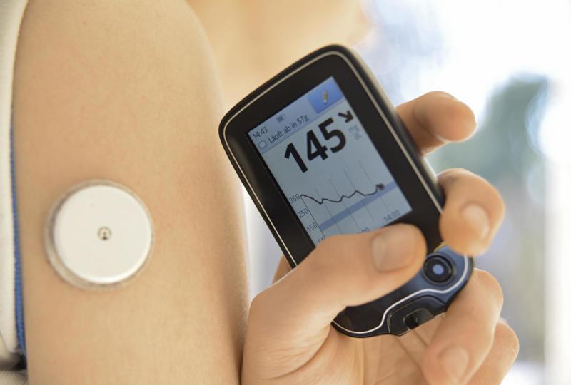 Continuous Blood Sugar Monitoring: Is it Right for You?