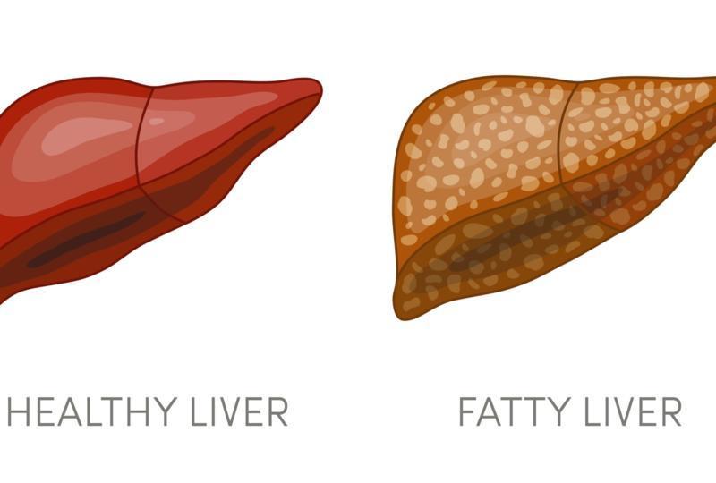 Effects of Diabetes on the Liver | FindATopDoc